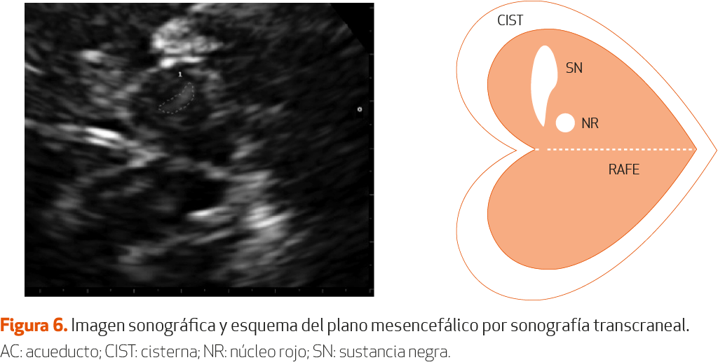 IMG CAP 2 FIGURA 6